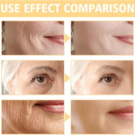 Bee Venom Wrinkle Removal Cream,Bee Venom Cream,Bee Venom Anti-Wrinkle Firming Multi-Purpose Cream,Bee Venom anti Aging Face Cream,Bee Venom Skin Treatment Cream for Face Neck,Moisturiser Face Women 2 49a4ab8959fb5d52ea003494d33b9c53