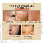 Bee Venom Wrinkle Removal Cream,Bee Venom Cream,Bee Venom Anti-Wrinkle Firming Multi-Purpose Cream,Bee Venom anti Aging Face Cream,Bee Venom Skin Treatment Cream for Face Neck,Moisturiser Face Women 4 62e80808c4f10fdd37678a3d984a8982
