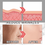 Bee Venom Wrinkle Removal Cream,Bee Venom Cream,Bee Venom Anti-Wrinkle Firming Multi-Purpose Cream,Bee Venom anti Aging Face Cream,Bee Venom Skin Treatment Cream for Face Neck,Moisturiser Face Women 6 a444f09d2549bbe19bf3034b8a01b2d6